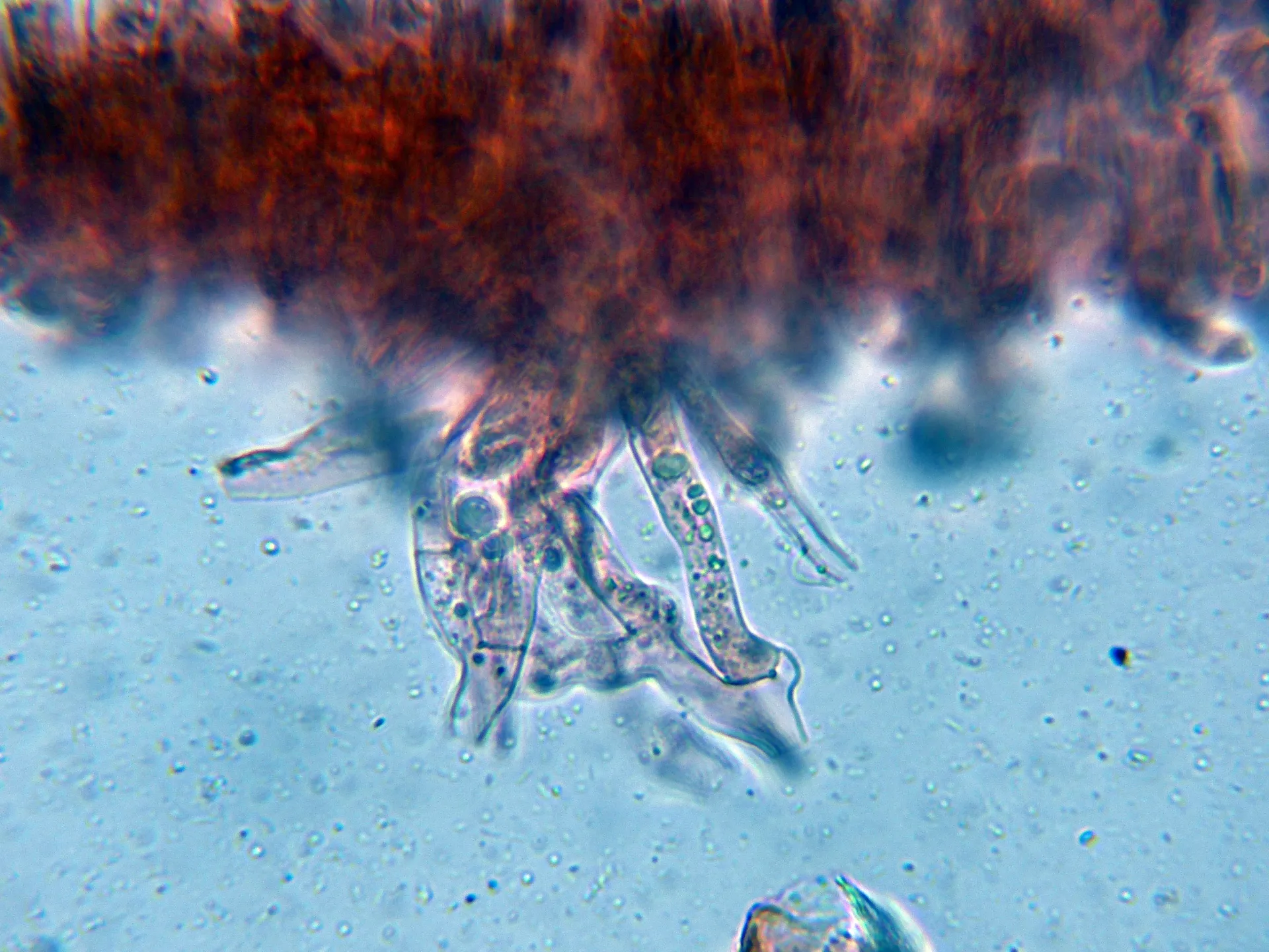 10 - Hifas subhimeniales-001